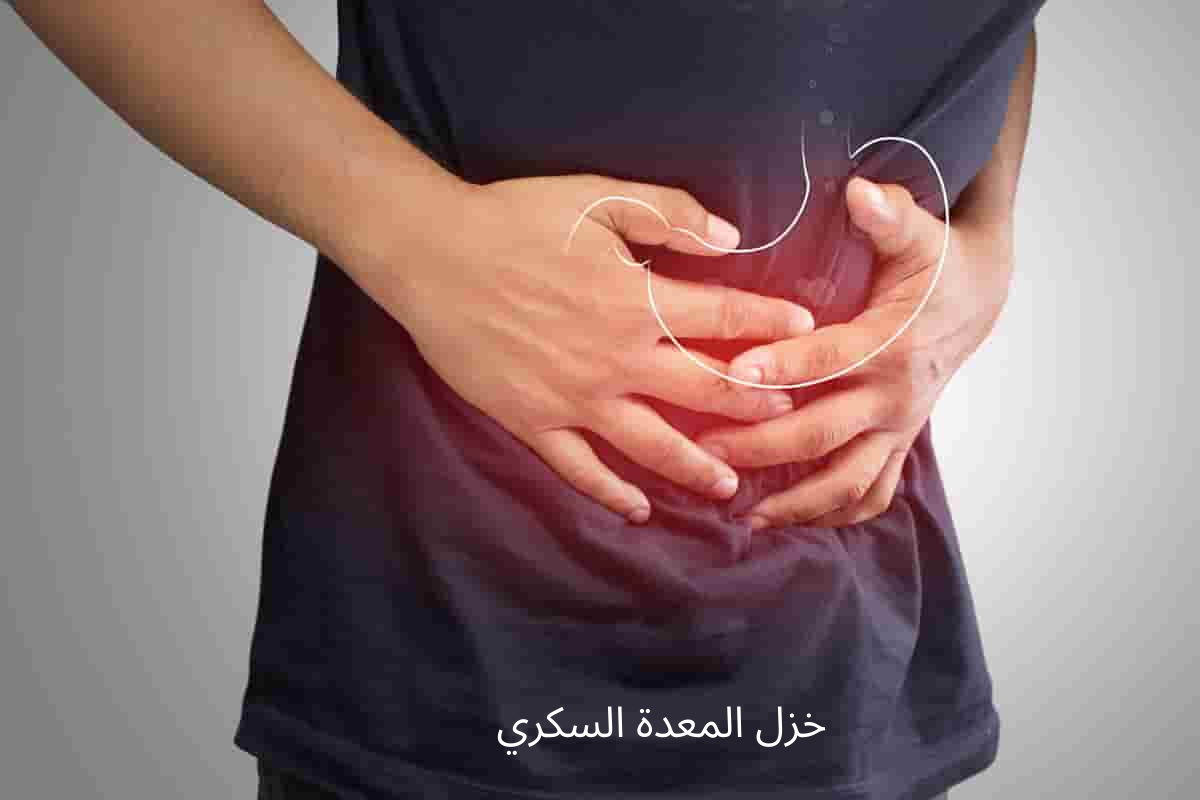 أعراض خزل المعدة السكري وأسبابه وعلاجه